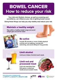 Bowel Cancer: How to Reduce Your Risk